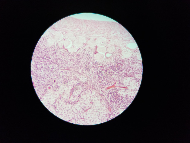 Ovary Slides - Ovary 015 400X